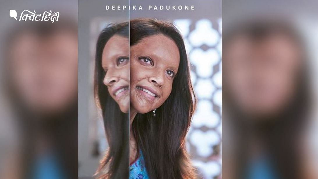 एसिड अटैक सरवाइर्स पर बनी दीपिका पादुकोण की फिल्म का पोस्टर