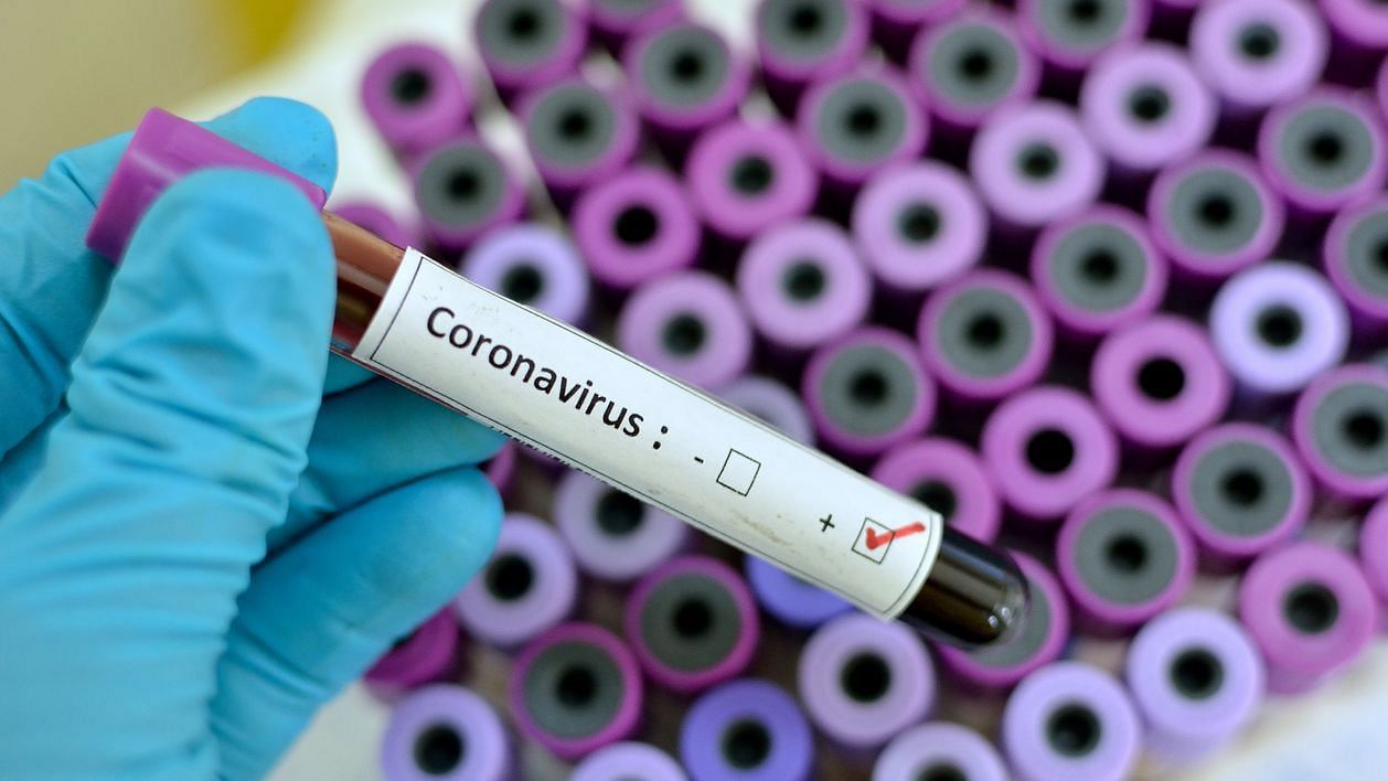 मध्यप्रदेश के मुरैना में दुबई से लौटे कोरोना वायरस से संक्रमित 45 साल को कोरोना वायरस से संक्रमित पाया गया है.