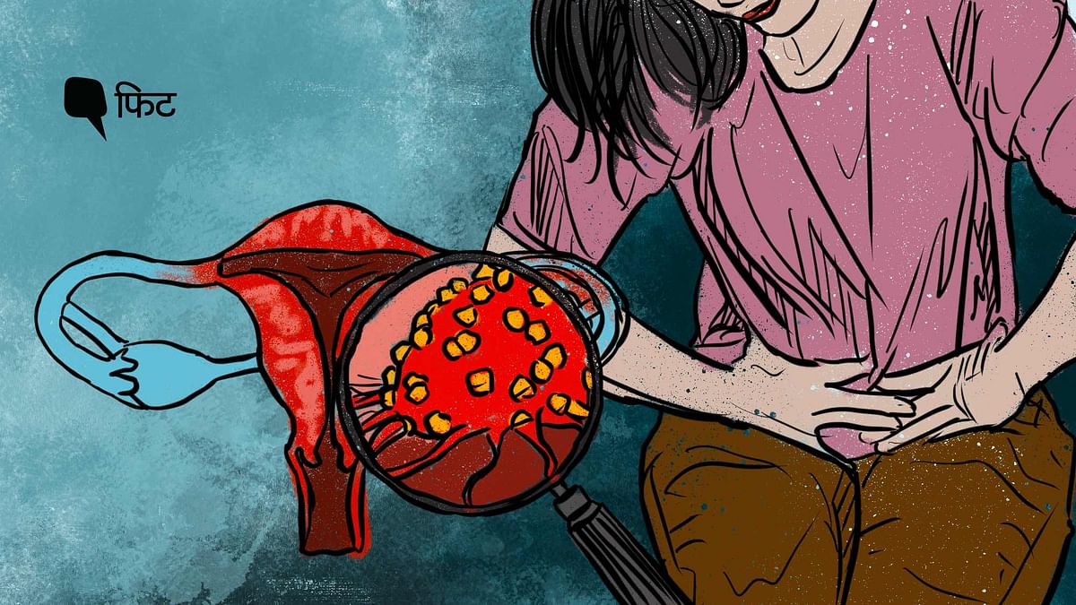 Menstrual Hygiene Day:क्या खराब मेंस्ट्रुअल हाइजीन से है सर्वाइकल कैंसर का खतरा 