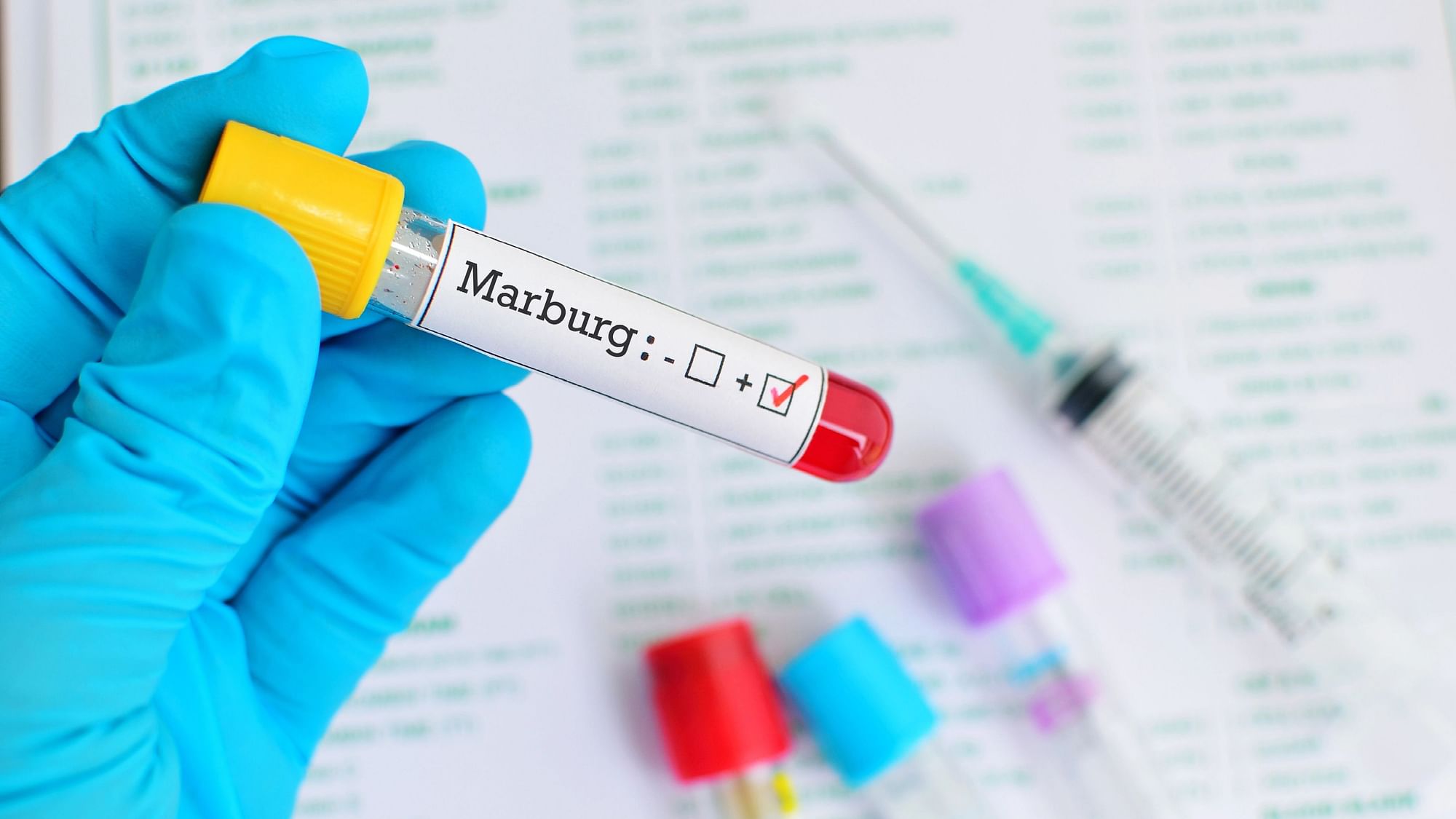 <div class="paragraphs"><p>Marburg Virus : घाना में दो लोगों की मारबर्ग वायरस से मौत हो गई है.</p></div>