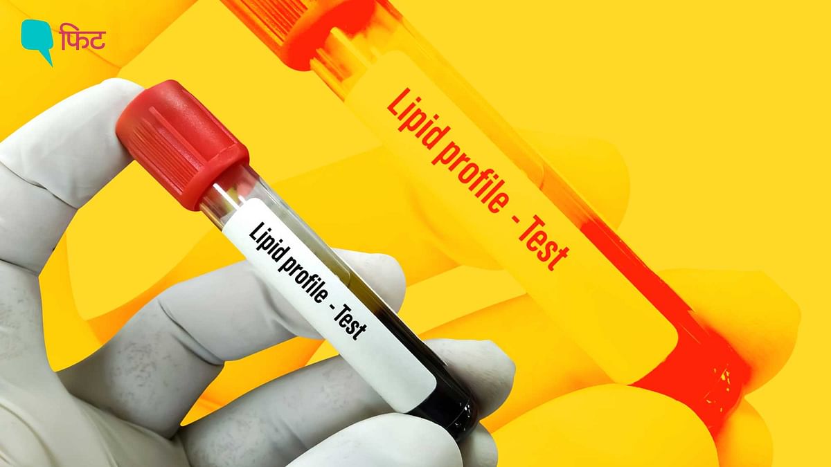 Lipid Profile Test: लिपिड प्रोफाइल टेस्ट में बढ़े हुए कोलेस्ट्रॉल का मतलब समझें
