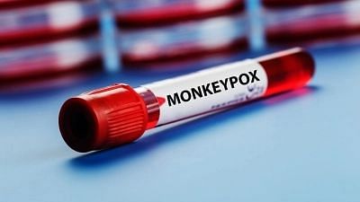 <div class="paragraphs"><p>Monkeypox: दिल्ली में मंकीपॉक्स का दूसरा मामला, देशभर में संक्रमितों की संख्या 6</p></div>