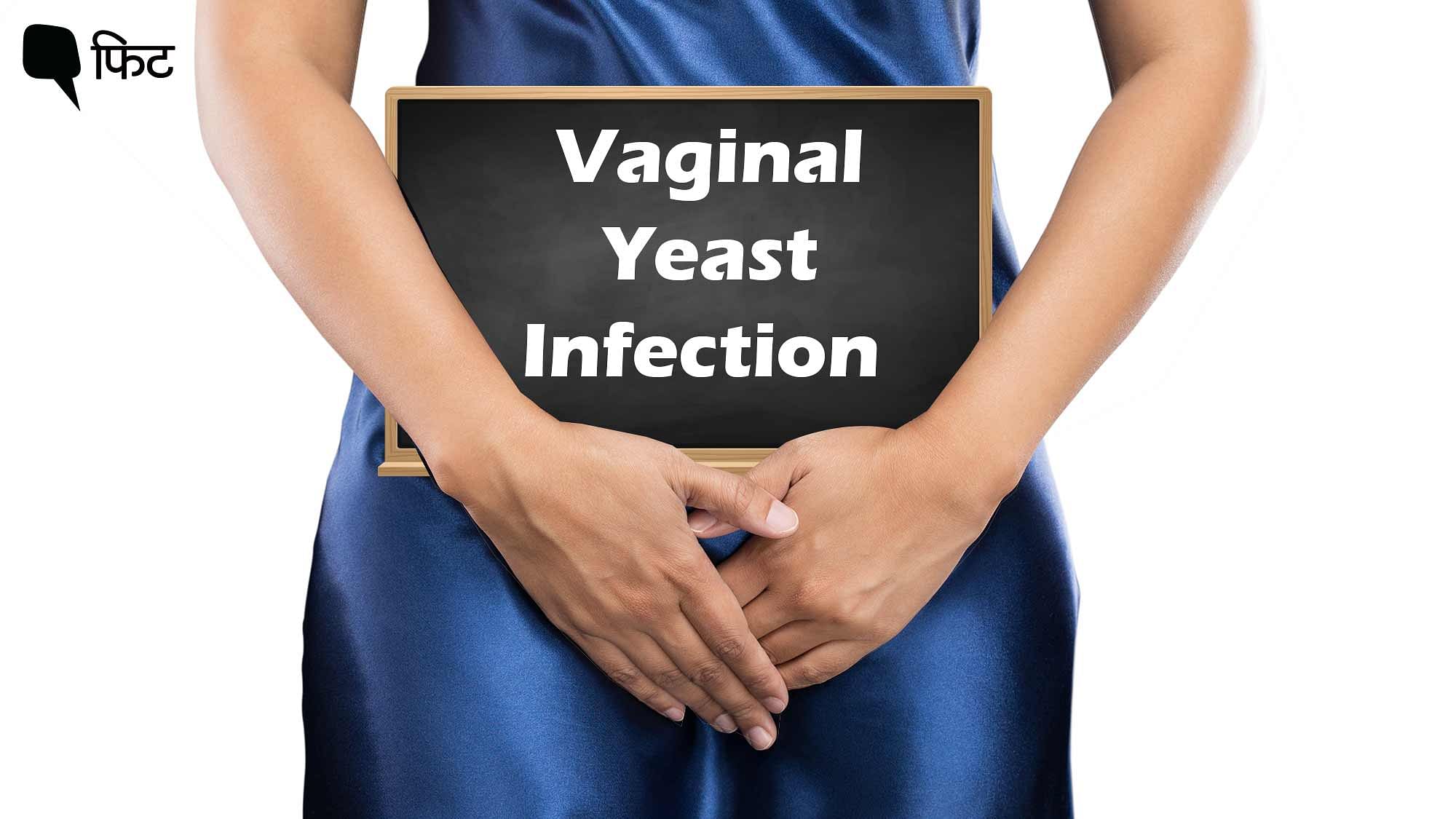 <div class="paragraphs"><p>Vaginal Yeast Infection: वजाइना या योनि में जलन और खुजली है इन्फेक्शन के लक्षण.</p></div>