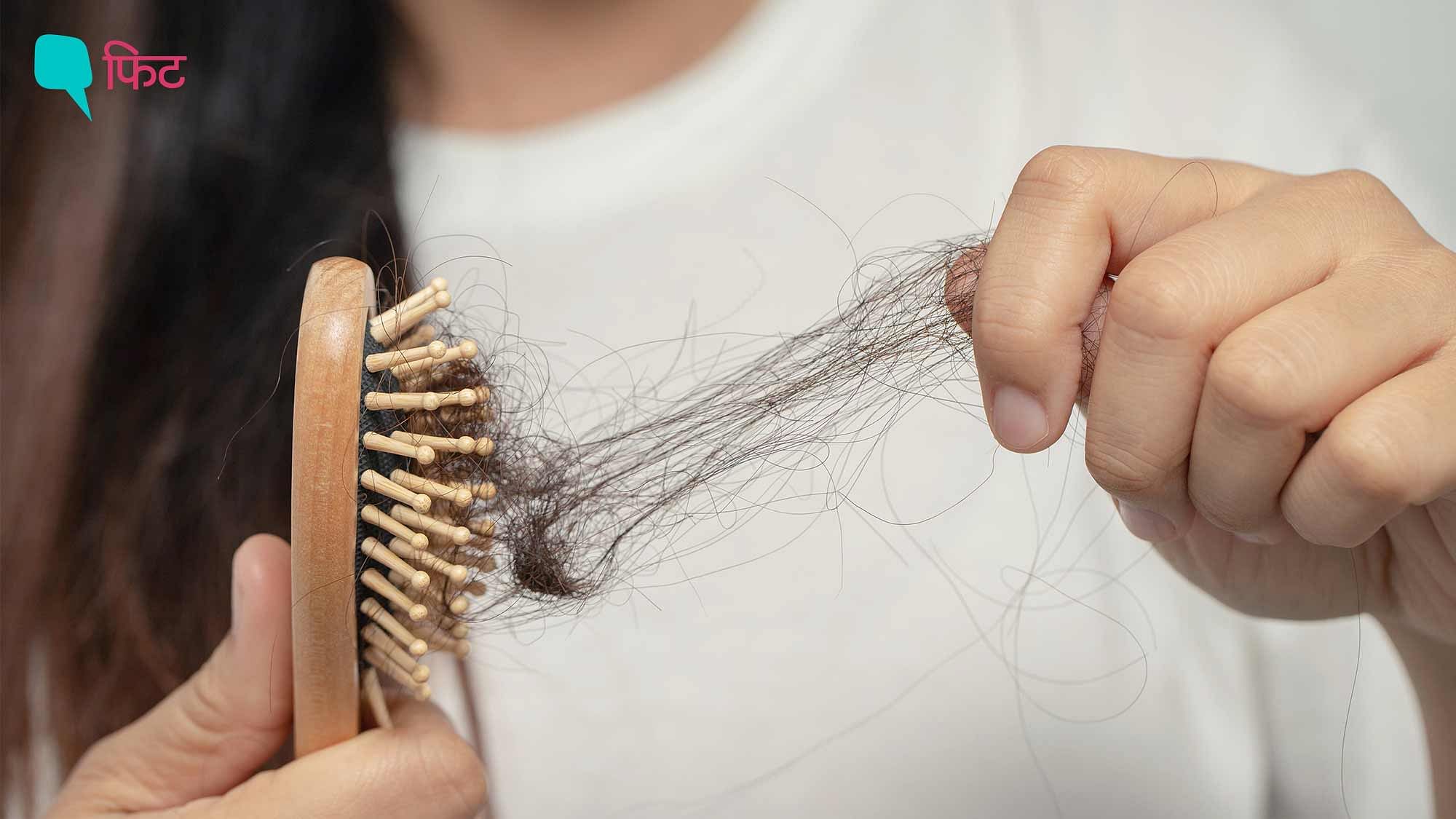 <div class="paragraphs"><p>Winter Hair Care Tips: सर्दियों में टूटते बालों का इलाज और बचाव बताते एक्सपर्ट्स</p></div>