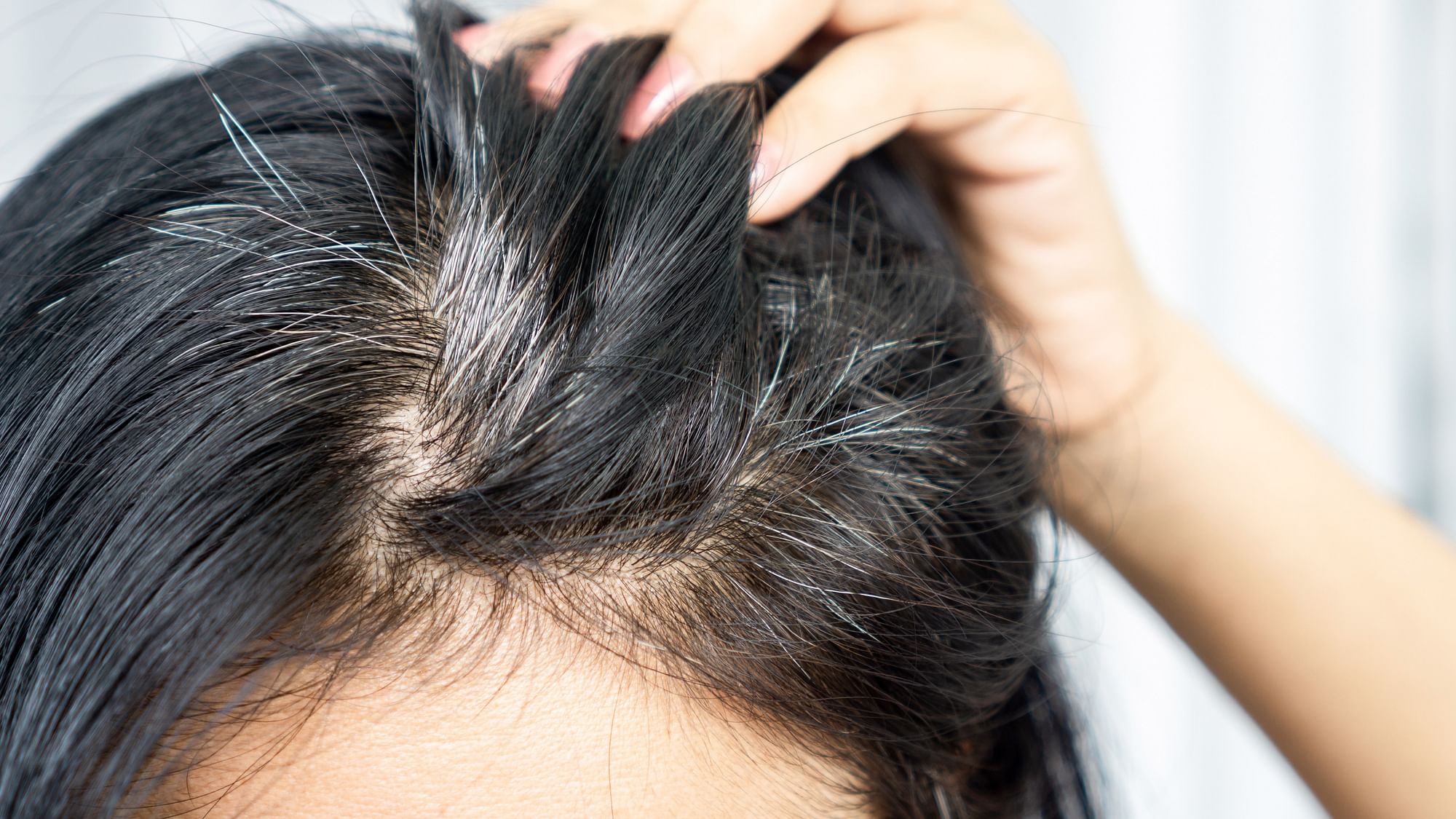 How to Stop Grey Hair Naturally  Mamaearth