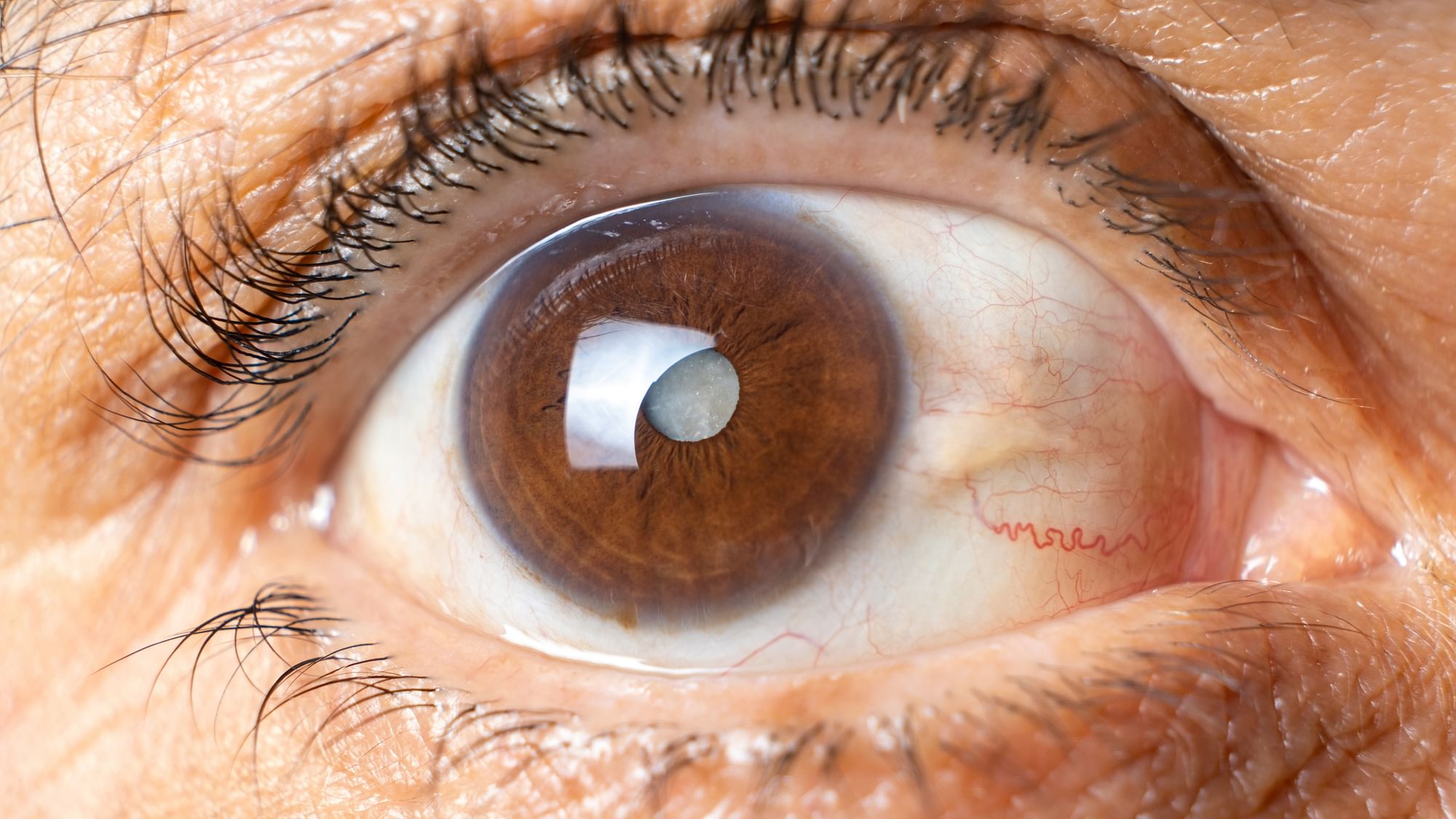 <div class="paragraphs"><p>Cataract Awareness Month 2023: क्या है मोतियाबिंद के इलाज का सही तरीका?</p></div>