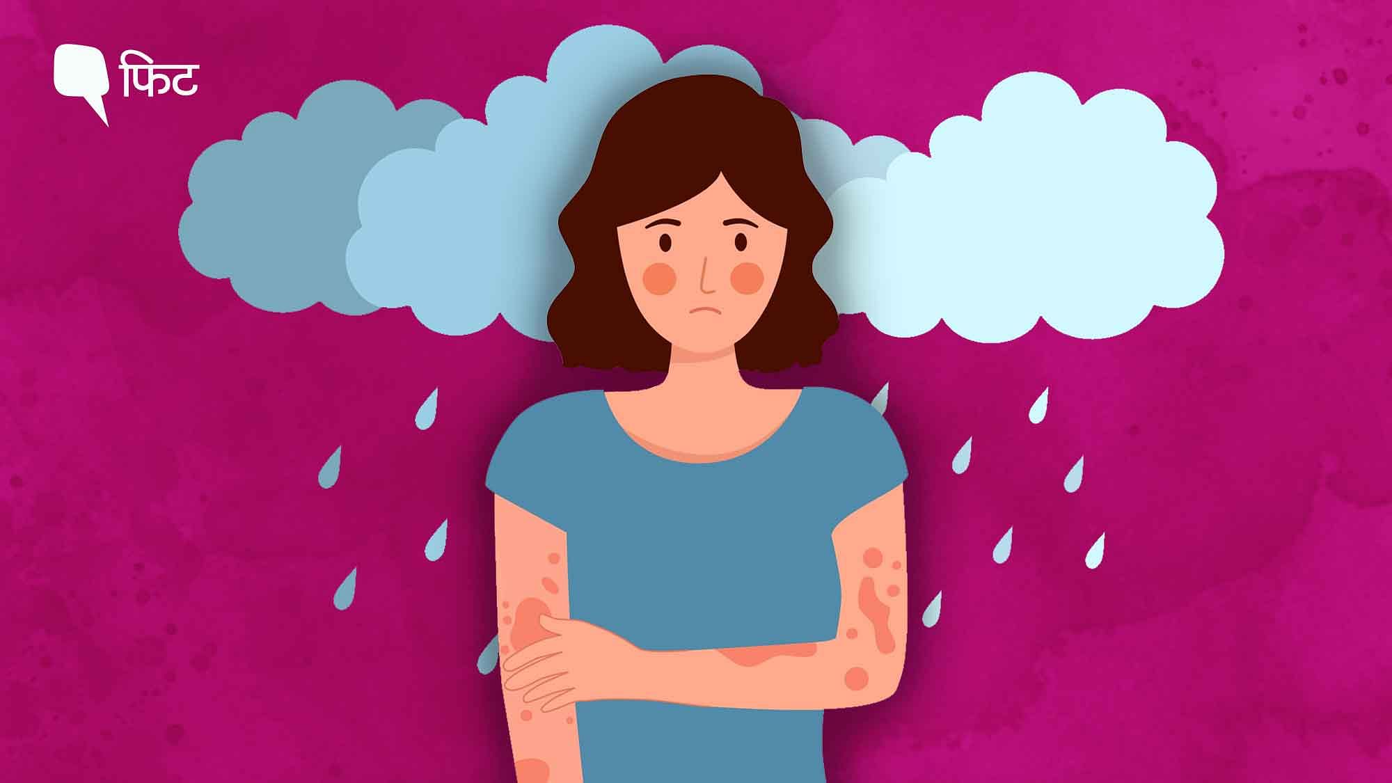 <div class="paragraphs"><p>Monsoon Skin Problem:&nbsp;मानसून  में नमी अपने आप बढ़ जाती है, जिसका असर स्किन हेल्थ पर पड़ता है.</p></div>