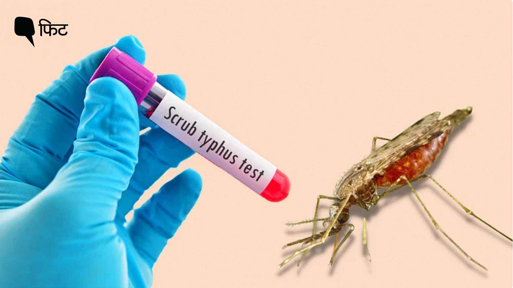 <div class="paragraphs"><p>Scrub Typhus से बचाव के उपाय और इलाज क्या हैं?</p></div>