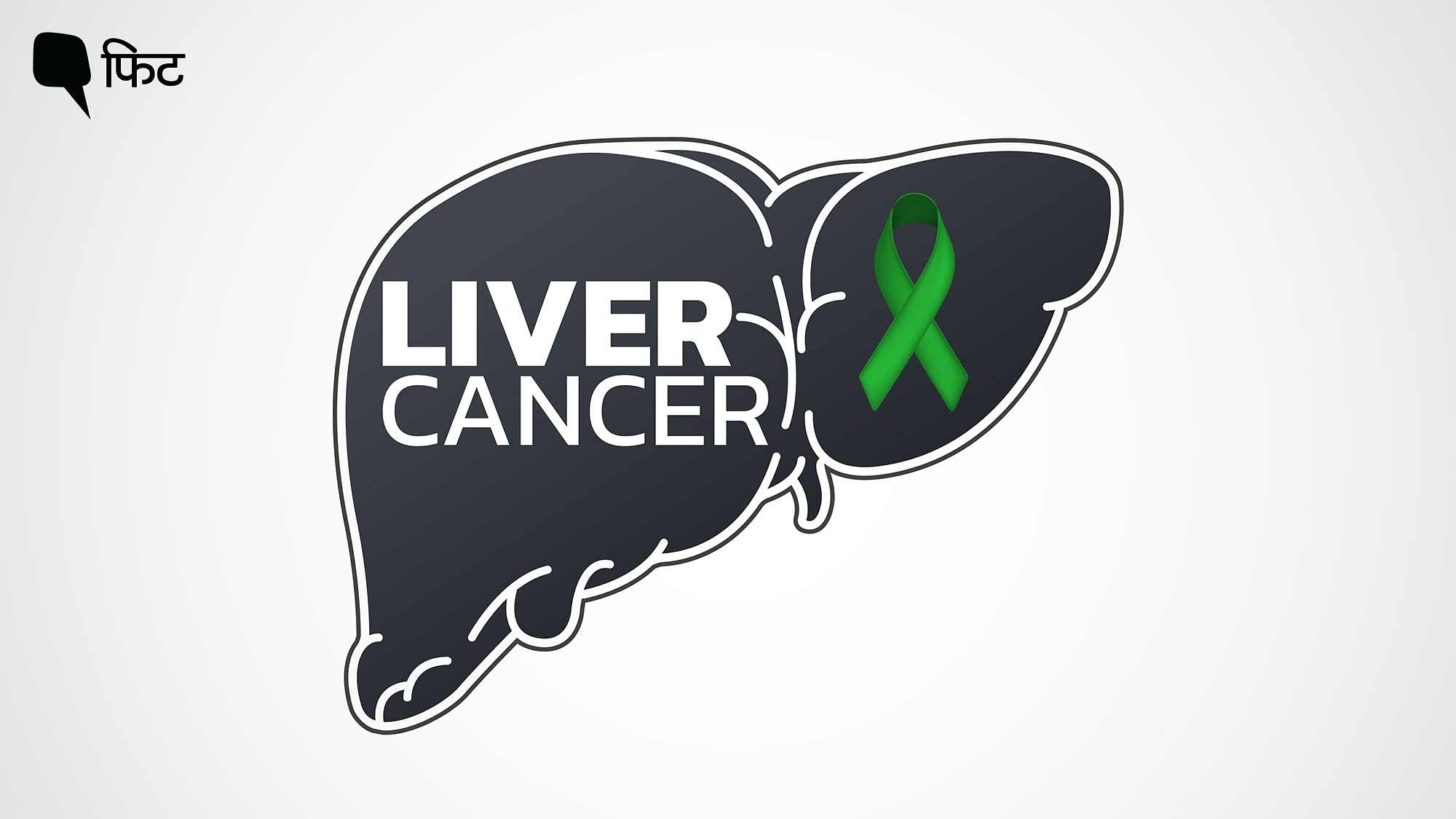 <div class="paragraphs"><p>Liver Cancer Precautions:&nbsp;लंबे समय तक इन्फेक्शन होने पर लिवर कैंसर होने का रिस्क रहता है.</p></div>