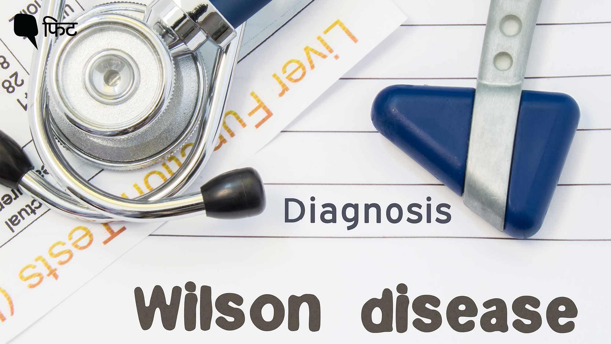 <div class="paragraphs"><p>Wilson Disease Treatment: विल्सन रोग के लक्षण, डायग्नोसिस और इलाज के उपाय क्या हैं?</p></div>
