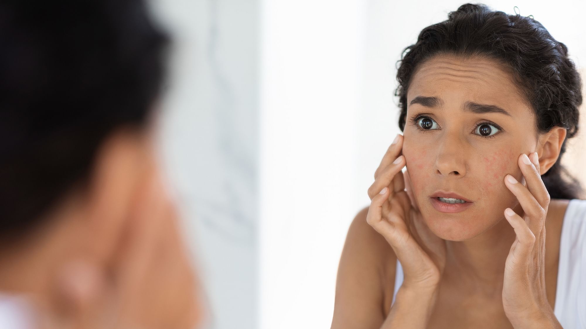 causes-and-triggers-of-acne-why-do-you-get-pimples