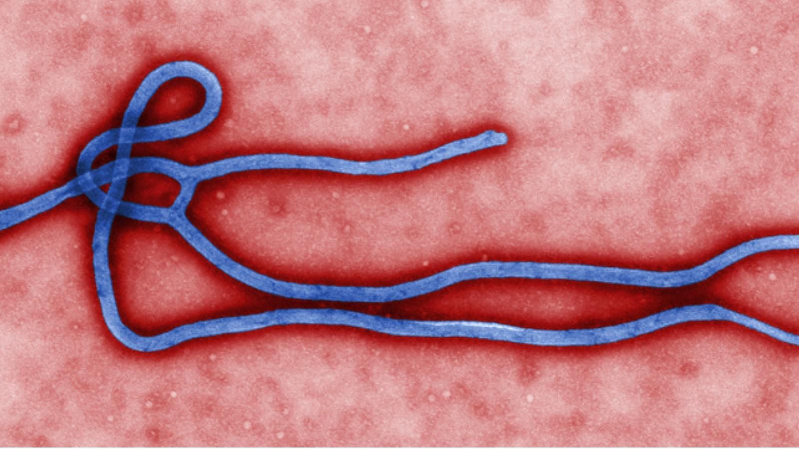 A microscopic view of the Ebola Virus.&nbsp;