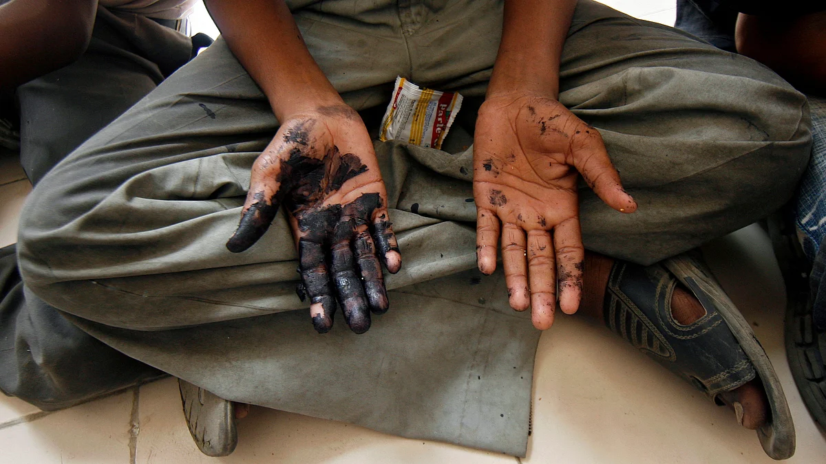 A child labourer shows his hands smeared with what he says are chemicals as he sits inside a police station in New Delhi after being rescued. (Photo: Reuters)