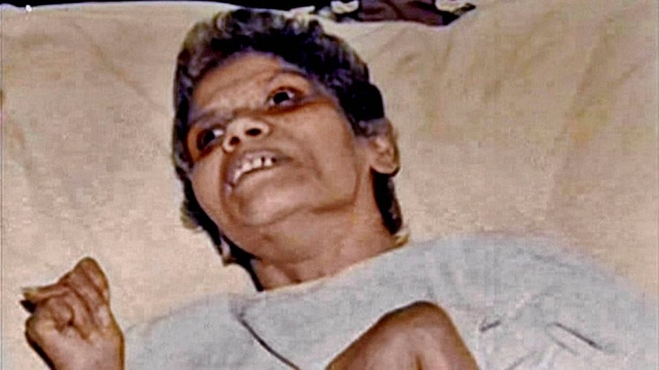 Aruna Shanbaug in KEM hospital. She had been in a vegetative state for decades. (Photo: PTI)