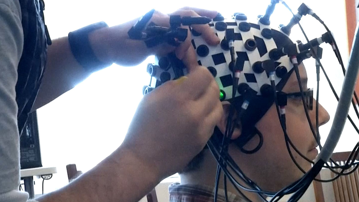 Video: Researchers Find New Tech To Peek Into Your Brains