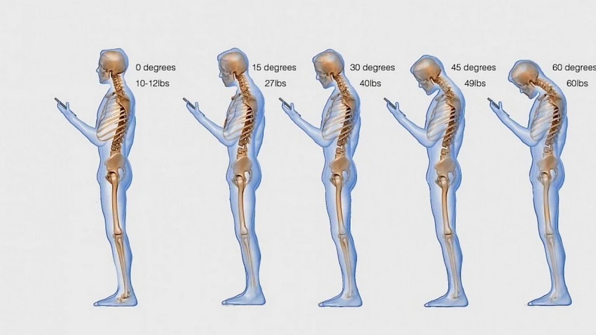 Look around you, everyone has their head down and this has doctors worried (Photo: National Library of Medicine)
