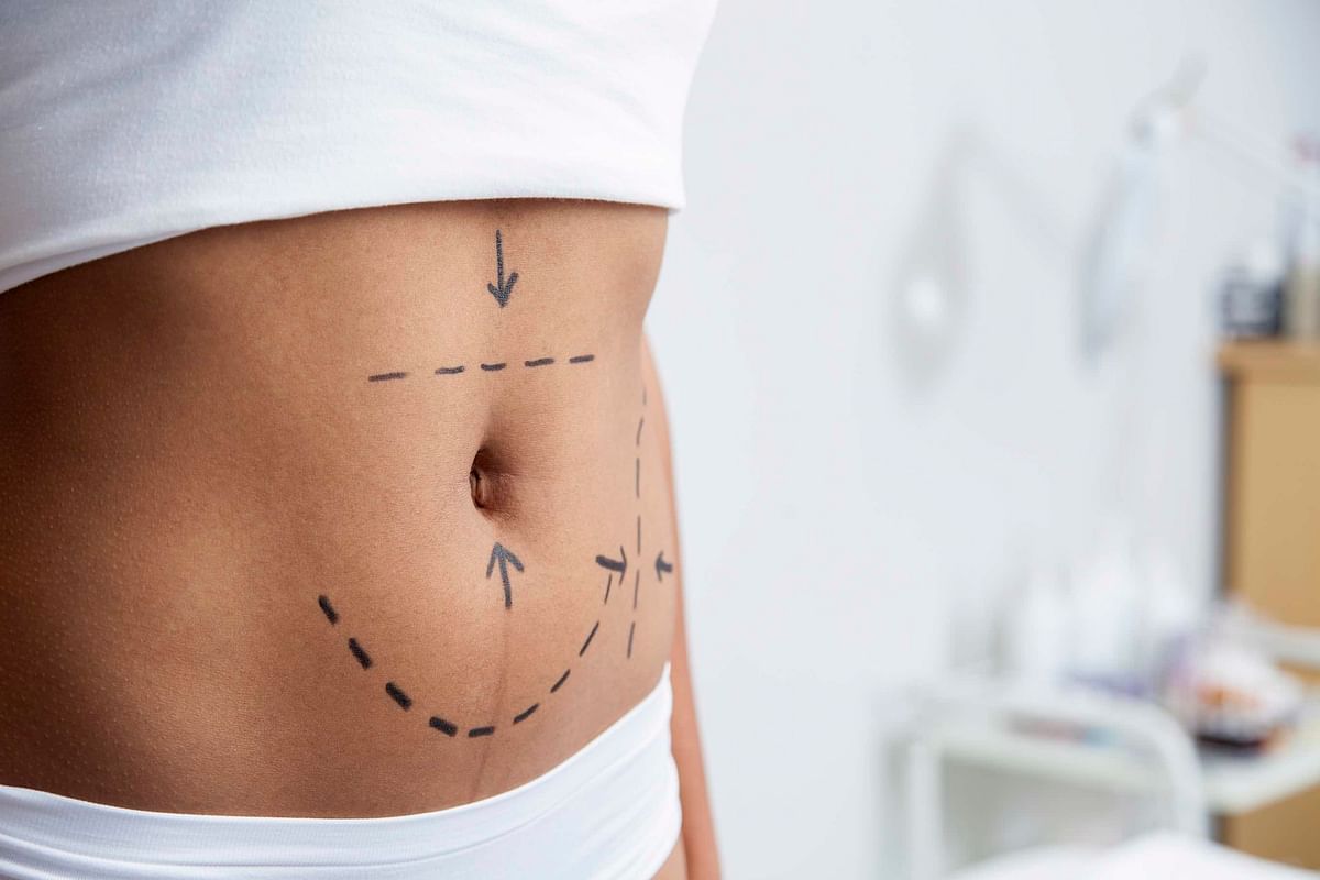  Liposuction is not like getting a haircut. It is a serious medical procedure. Are the risks ever worth it? 