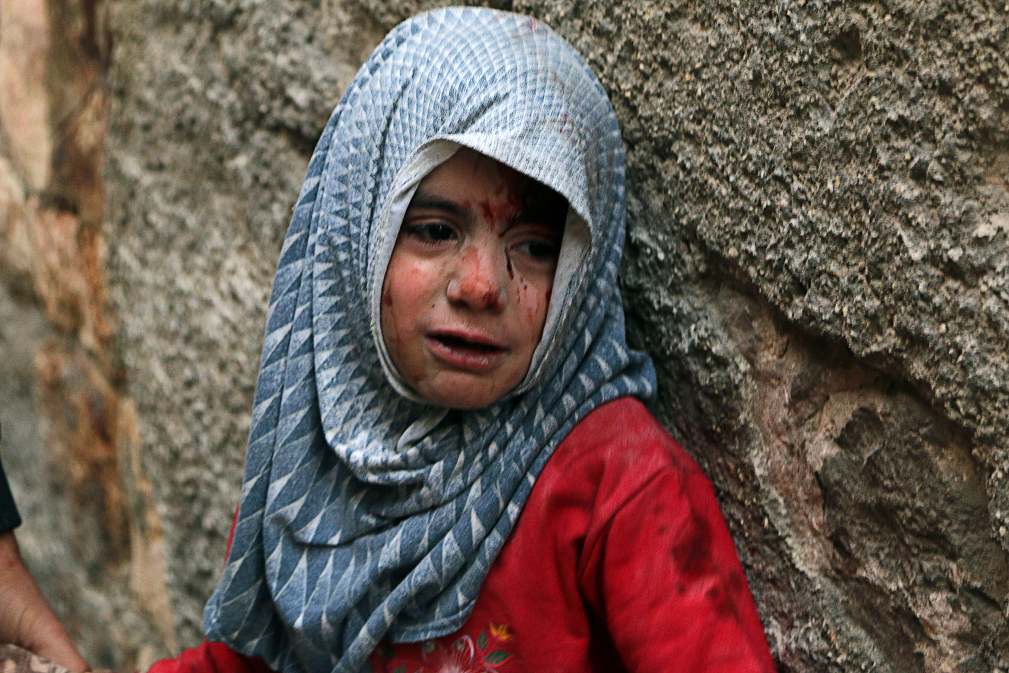 An injured girl reacts during what activists said were air strikes by forces loyal to Syria’s President Bashar Al-Assad, in the Bab al-Hadid district of Aleppo, November 30, 2014. (Photo: Reuters)