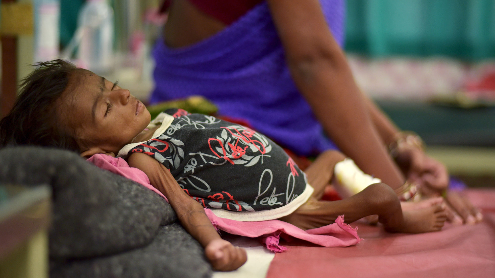 Two-month-old Jyoti lies in a bed in a malnutrition intensive care unit in Dharbhanga Medical College in Dharbhanga in the eastern state of Bihar. (Photo: Reuters)