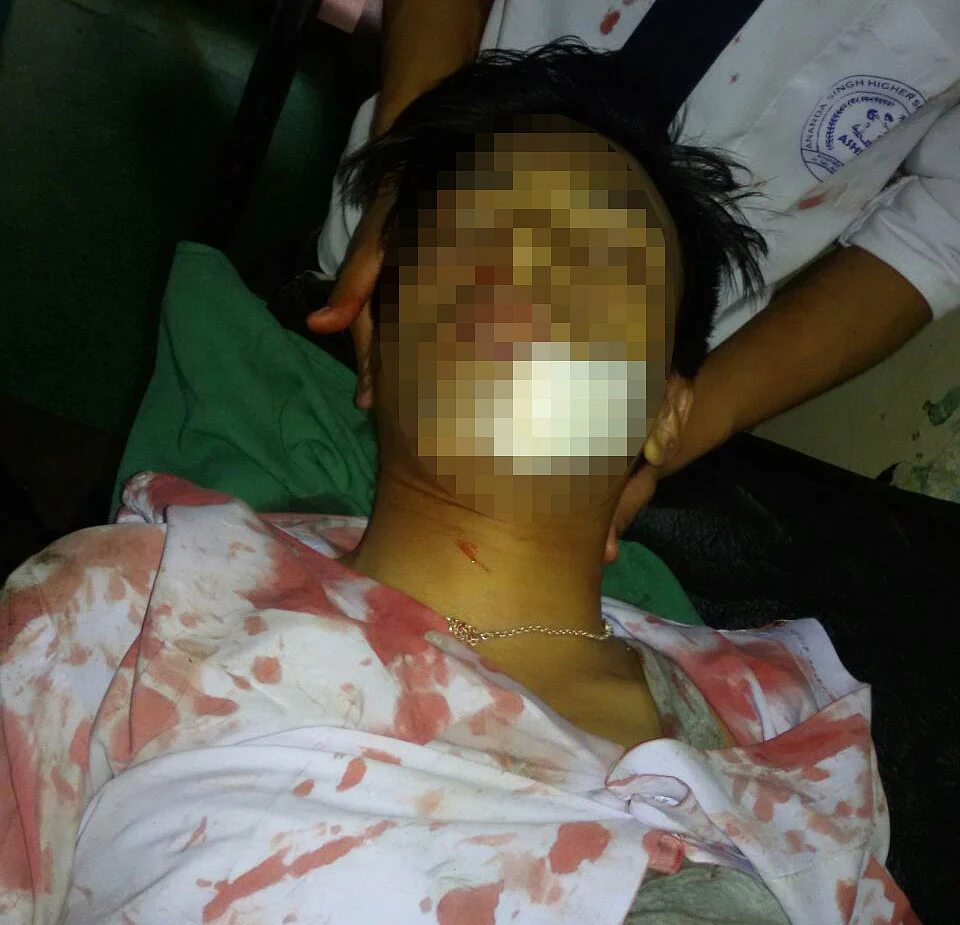 The body of 16 year old Sapam Robinson Singh, who was killed in Imphal after being hit by a tear gas shell. (Photo: Sunzu Bachaspatimayum)