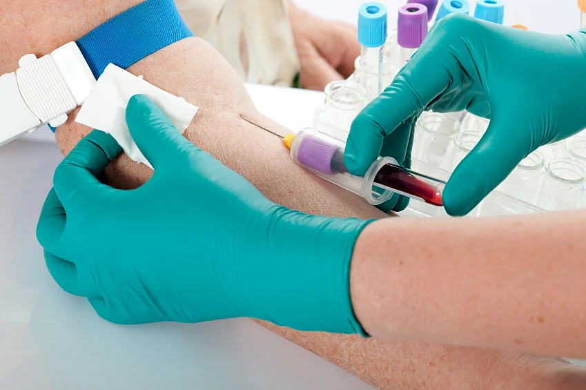 Health workers receive skills and expertise needed for taking care of viral Hepatitis patients on-the-job (Photo: iStock)