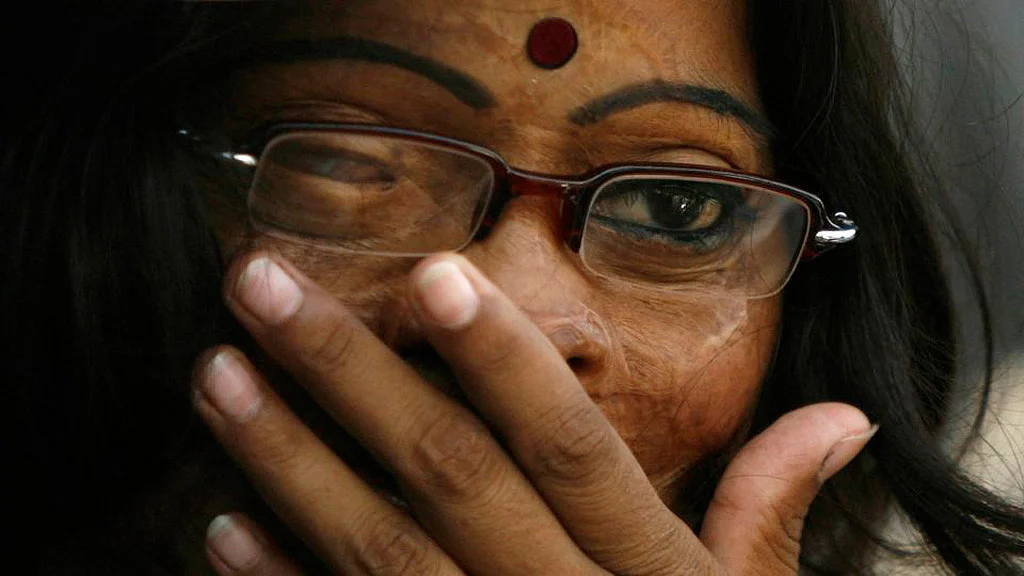 An acid attack survivor. (Photo: Reuters)