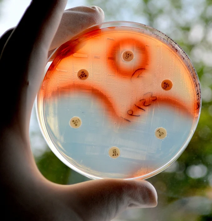 Earlier this year, 40% of poultry samples tested for six antibiotics by the Centre for Science and Environment (CSE), tested positive for antibiotic residue; 23% of the samples contained residues of one antibiotic and 17% had residues of more than one (Photo: iStock)