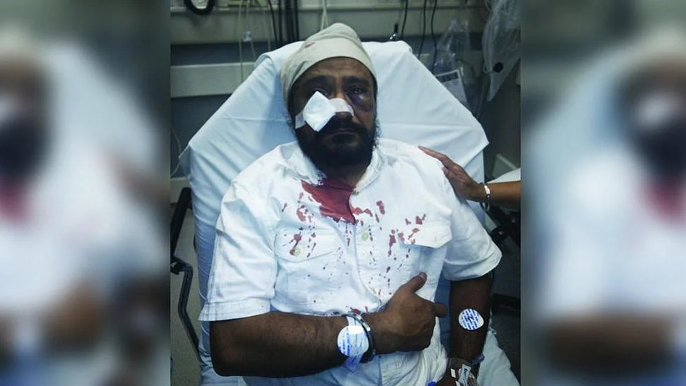 Inderjit Singh Mukker was assaulted on Tuesday when the assailant pulled up to his car yelling racial slurs. (Courtesy: Sikh Coalition)
