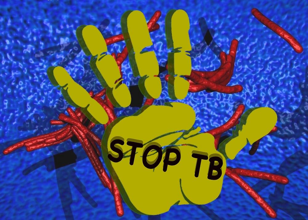 Great news for the 1 million children who get infected by TB every year: a new drug will make treatment much easier