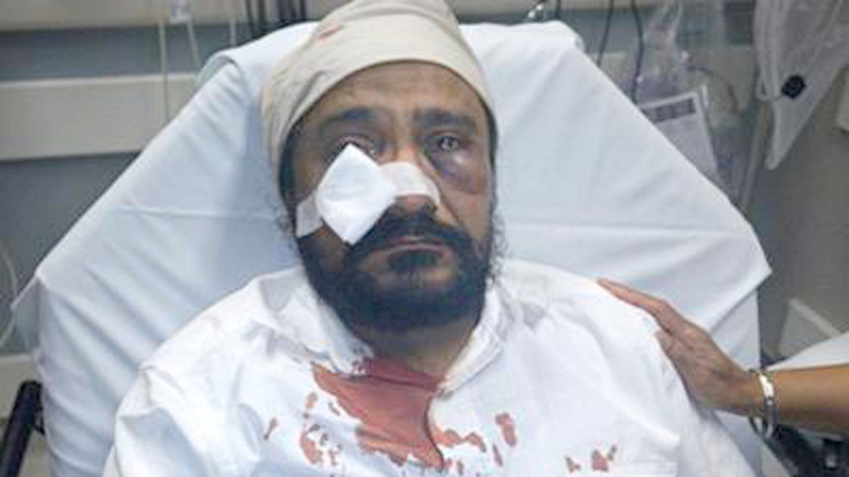California police are investigating a brutal assault on a Sikh man, whose collarbone was broken, as a hate crime.