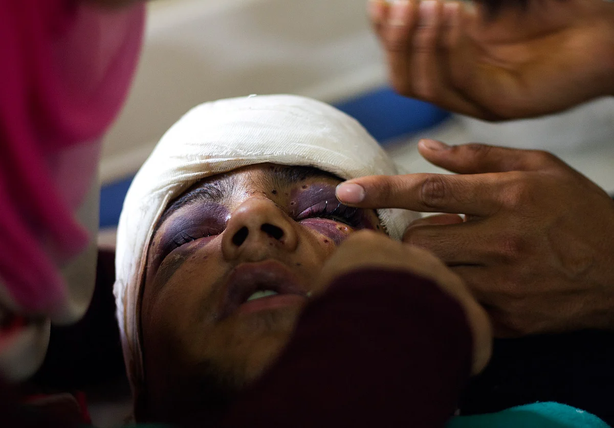Hamid Nazir injured in pellet-firing by paramilitary forces to disperse a protest in Palhalan, Kashmir, on May 21 2015, death anniversary of Mirwaiz Mohammad Farooq. (Photo: Shahid Tantray)