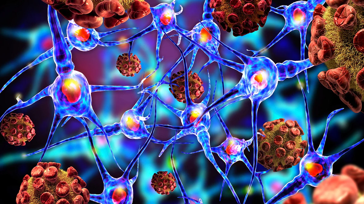 Khesari dal is apparently associated with a neurotoxin, ODAP that causes paralysis of lower limbs. (Photo: iStockphoto)