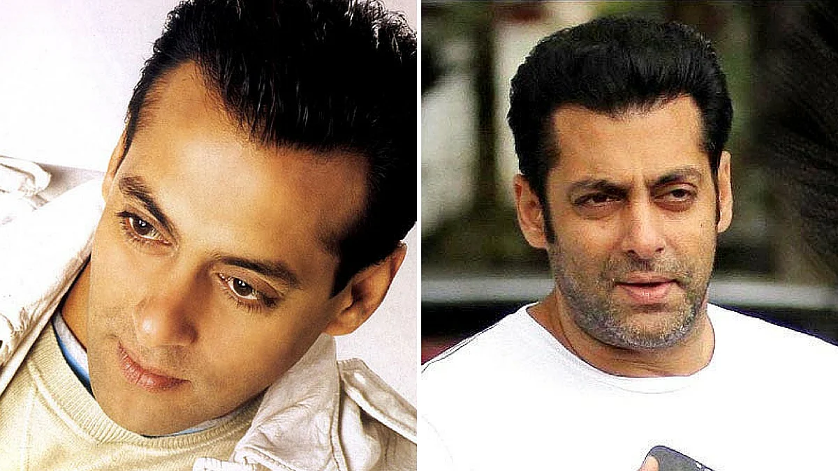Pre and post hair transplant: Salman Khan. (Photo: <b>The Quint</b>)