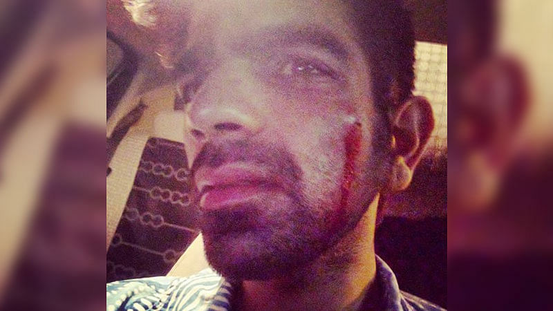 26-year-old Daksh Bhardwaj was beaten by a mob  for swearing in Mumbai. (Photo: Facebook/<a href="https://www.facebook.com/daksh.bhardwaj?fref=ts">@Daksh Bhardwaj</a>)