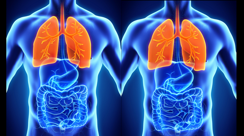 The economic burden of TB to the Indian economy between 2006 - 2014 is estimated to be a staggering $340 billion <i>(Source: Report by the Joint Monitoring Mission of the RNTCP) </i>(Photo: iStock)