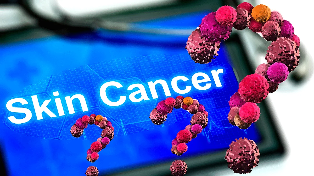 The discovery is significant because changing or irregular moles are thought to be a key sign of melanoma (Photo: iStock altered by The Quint)
