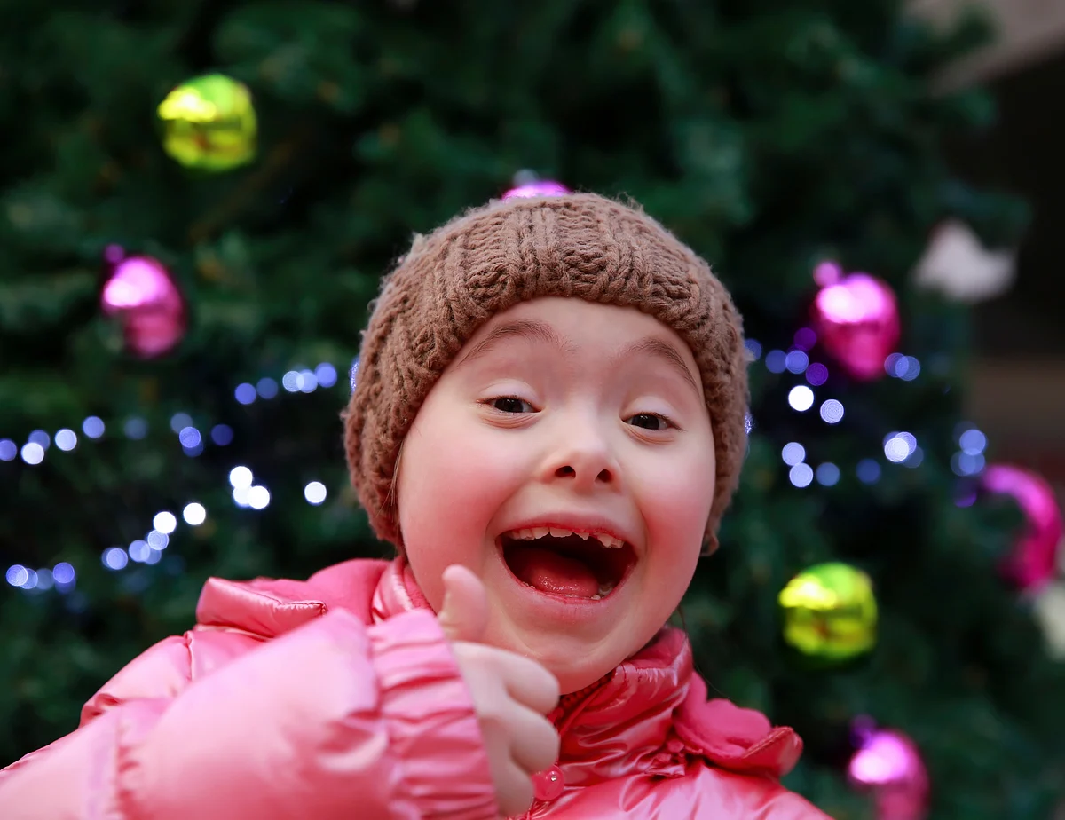 Down syndrome is a lifelong condition. But with care and support, these children can grow up to have healthy, happy, productive lives.
