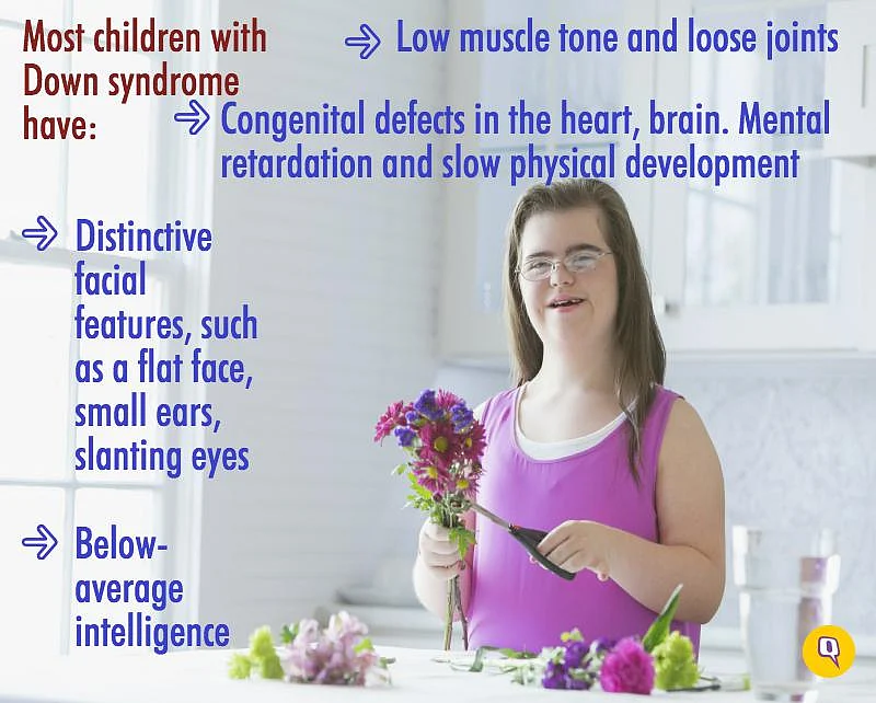 A new parent of a baby with Down syndrome is going to be scared, confused, worried, and grieving for a long while.