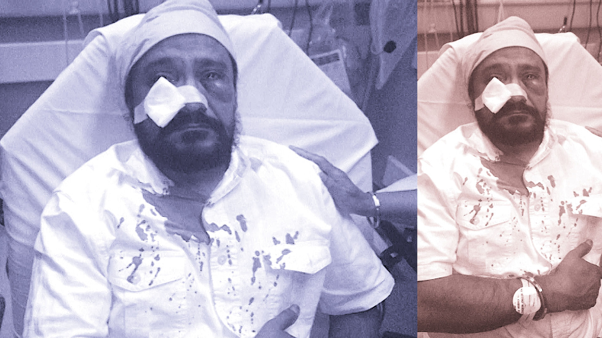 Sikh-American man Inderjit Singh Mukker was attacked last year by an American teen (Photo: altered by <b>The Quint</b>)