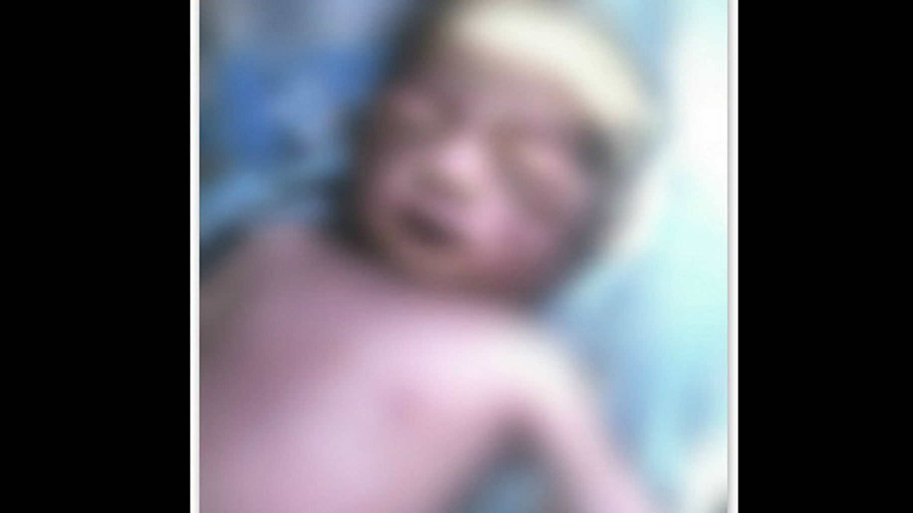 Injury marks were found on the baby’s body. (Photo Courtesy: <i>The News Minute</i>)
