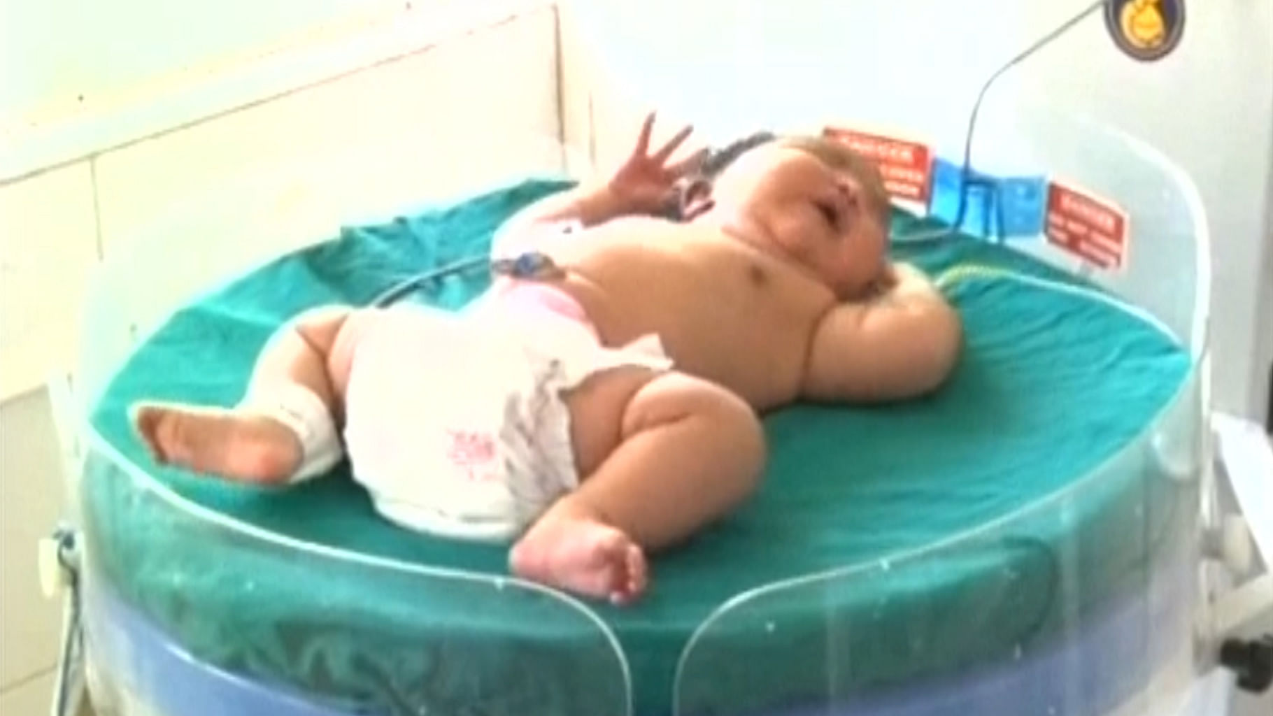 Weighing 6.8 kg, this baby girl born in Hassan, Karnataka is possibly the heaviest baby in India. (Photo Courtesy: AP screengrab)