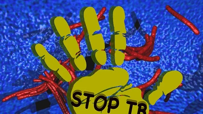 The average cost to a family who has one person suffering from TB can amount to as much as 39% of annual household expenditure – a catastrophe for any family already impoverished <i>(Source: Report by the Joint Monitoring Mission of the RNTCP) </i>(Photo: The Quint)
