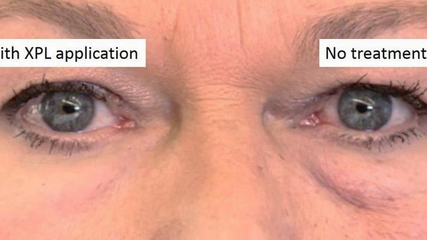 Scientists at MIT just found a magical fix for under-eye bags and wrinkles. For real!