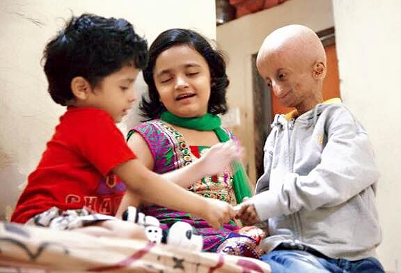 Nihal Bitla, the public face of Progeria in India passed away at the age of 15. Rest in peace, Nihal!