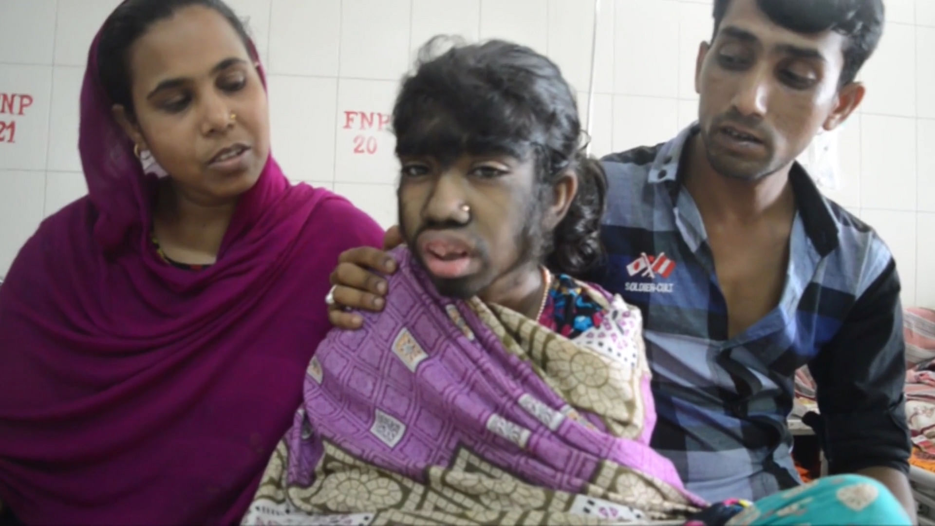 Bithi’s miserable condition left her parents both distressed and worried for her future. (Photo: AP screengrab)