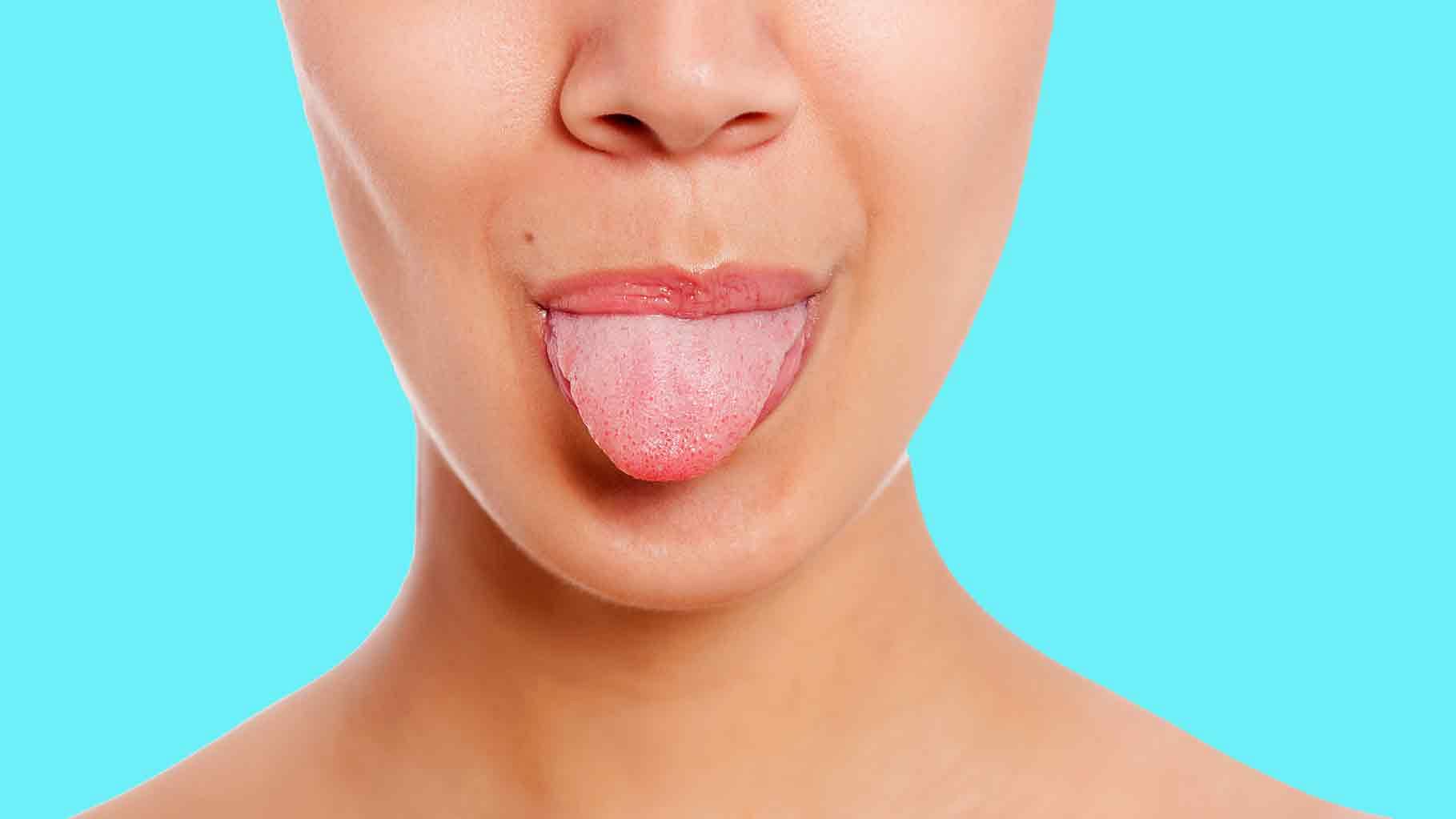 The colour, texture and moisture of your tongue signals a lot about what’s going on in your body (Photo: iStock)