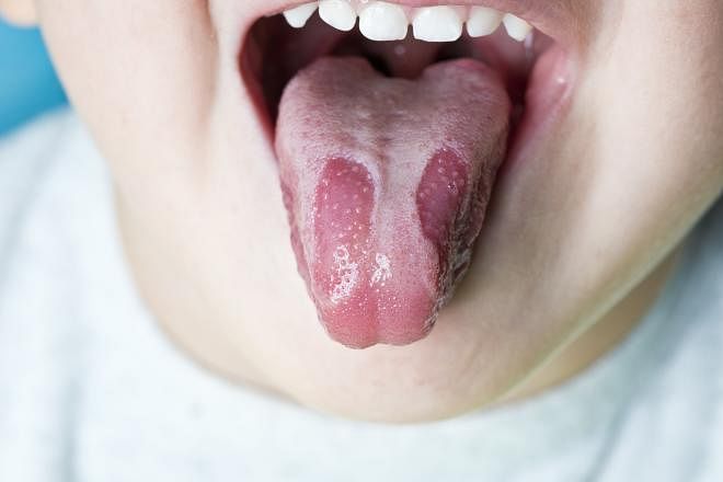 Is your tongue sending signs about your health? You can learn a lot by opening your mouth