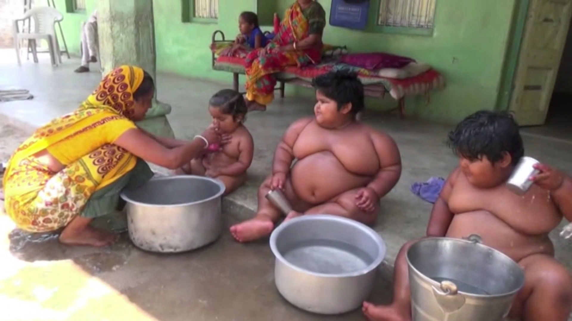 Ramesh Nandwana from Una, Gujarat says the kids lost a little weight initially after surgery but have been steadily putting on kilos ever since. (Photo: AP/Newsflare Screengrab)