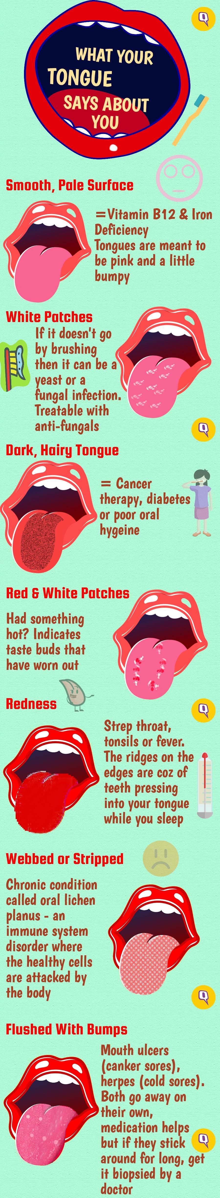 Is your tongue sending signs about your health? You can learn a lot by opening your mouth