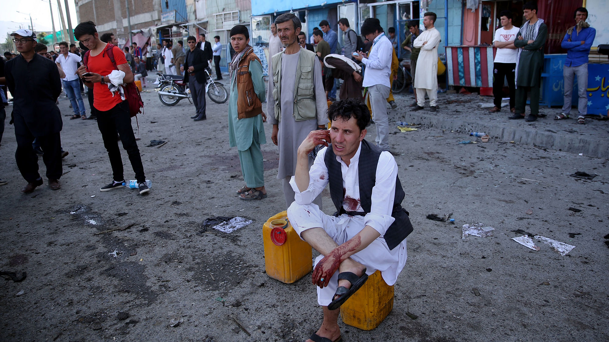 A bloodied man who carried the dead and wounded speaks on the phone at the site of a suicide attack  in Kabul, Afghanistan on Saturday. (Photo: AP)